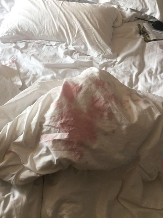 杜先生弄脏的被套。来源:当代生活报