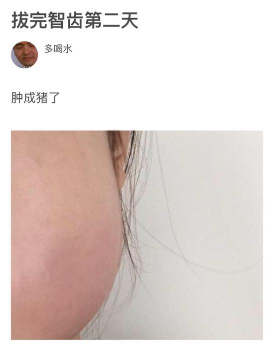 囧哥:脱高跟鞋飞抛！纽约时装周2女星大打出手,一人脸上挂彩