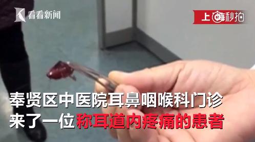 囧哥:报名计算机考试照片传成表情包 委员会表示不能改只能换方向