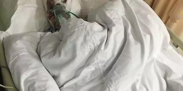 杭州养5年的罗威纳犬突然猛咬主人 伤口和被老