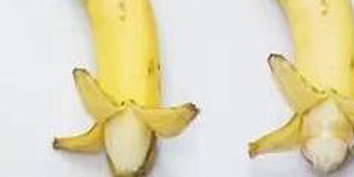 杭州暑假割包皮小男孩排长队 浙大儿院已经约