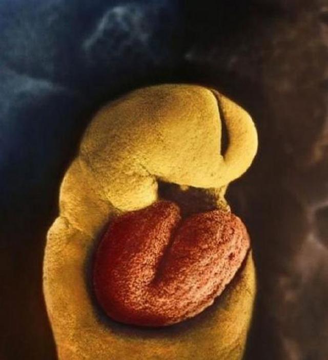 33 从受精卵到新生命,拍摄胎儿孕育的全过程