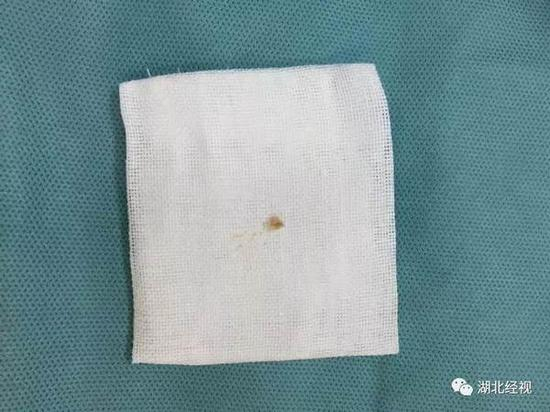 半颗牙齿