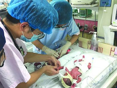 四胞胎小姐妹还在医院里接受监护