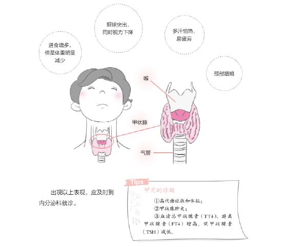 【育儿科普】甲亢女性要如何备孕？