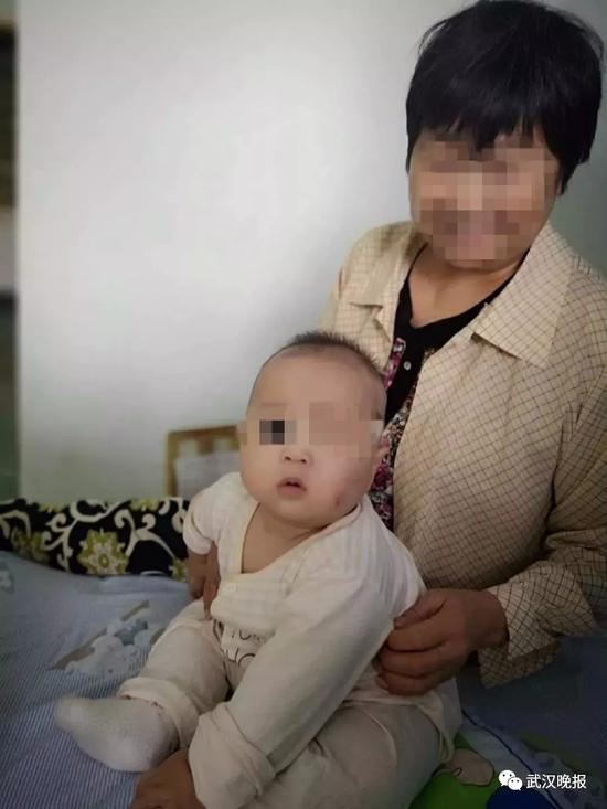 半岁宝宝被恶犬叼走咬穿颅骨