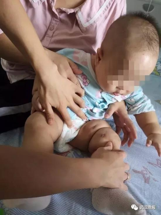 半岁宝宝被恶犬叼走咬穿颅骨