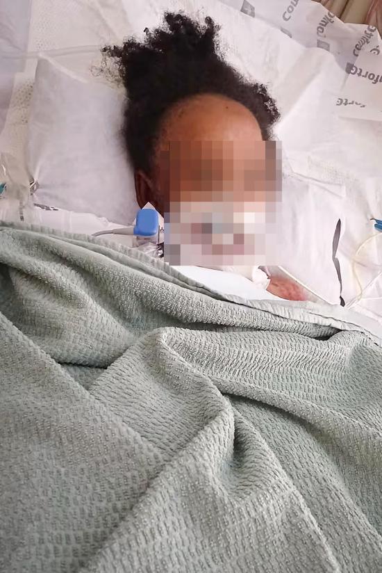 一个4岁的男孩感染了败血症，他的心脏停止了跳动。他依靠“人工肺”维持了19个小时，然后再次开始跳动。