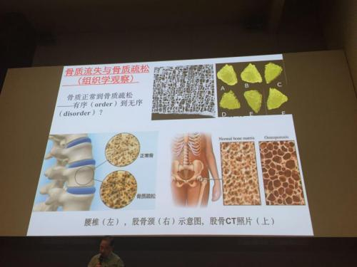上图是商鹏院长希望洗出来挂在办公室的骨密度图