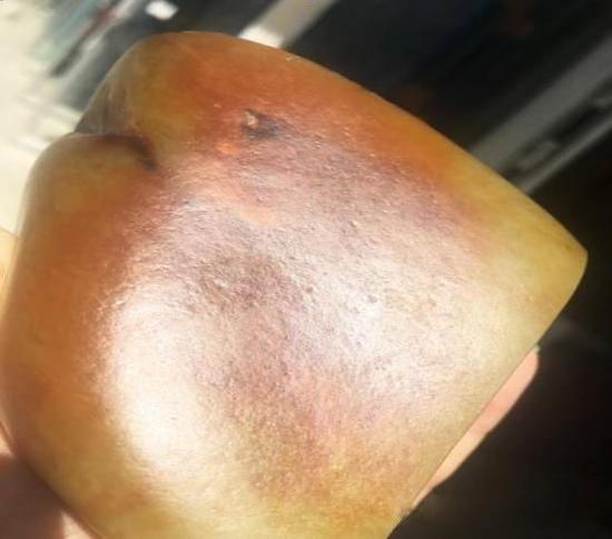 子料表面凹凸不匀的汗毛孔