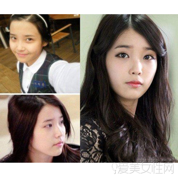 IU