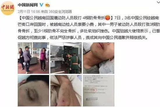 　　2017年2月7日，三名中国游客从越南芒街回国时，被越南边检人员索要“小费”，其中一人被打骨折&nbsp; 图：中新网微博截屏