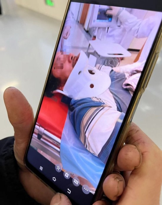 幸存者李亚有在医院接受治疗。图/九派新闻徐鸣　翻拍