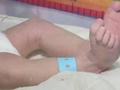 妻子产下六斤男婴腹部“长出一根手指” 丈夫一看当场吓晕