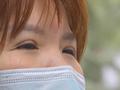 女子做眼部修复后留下疤痕 整形机构:可以重做