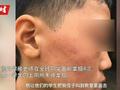 湖北学生遭老师当全班面掌掴 教育局:正在调查中
