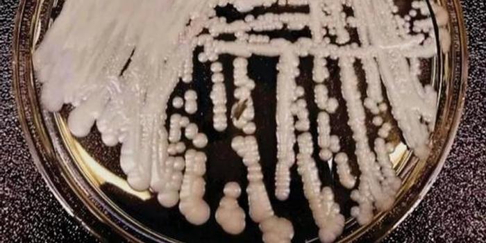 超级真菌致死率60% 中国已有18例确认感染