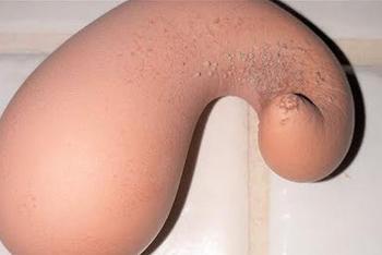 便便形鸡蛋吓坏农妇