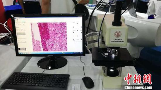 上海交大关新平教授团队研发的多维高分辨率数字病理扫描仪工程化样机。 本文图均为 中新网 图