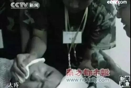 杨永信电击法治疗学生