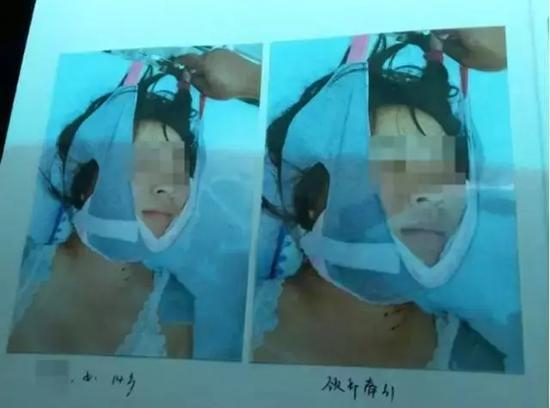 被殴打成重伤的玲玲