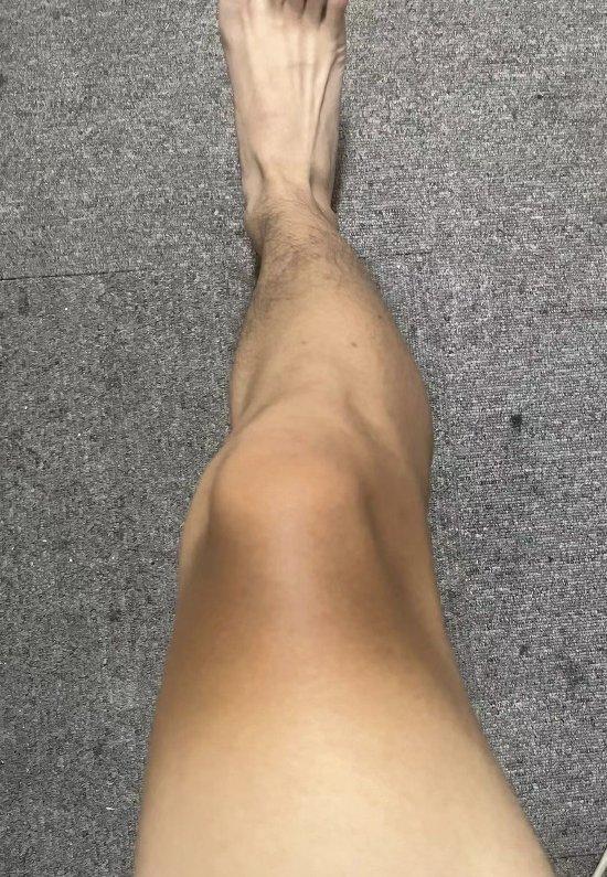 王盛宇送餐时,坐在车上太阳直射膝盖上方,脚被晒得黑一段,白一段。