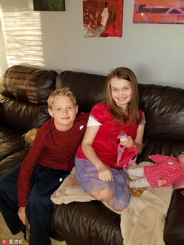 17岁的hailey knecht来自美国,因为患有无法治愈的小儿亚历山大症