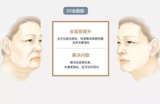 解决问题