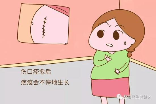 疤痕体质