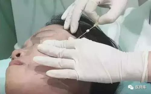 步骤