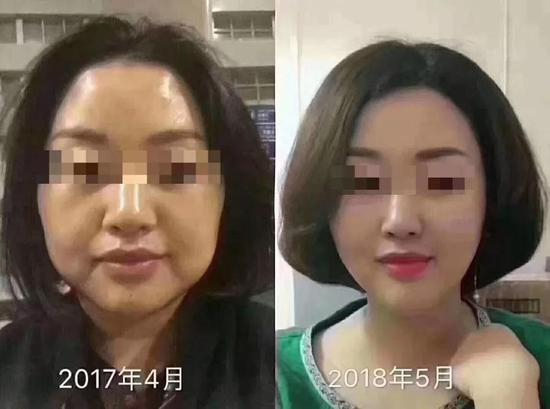 对比