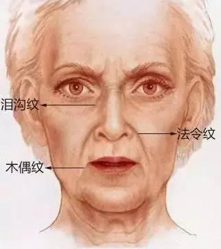 “三八纹”