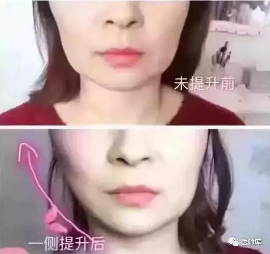 效果对比