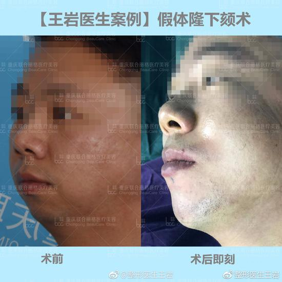 案例对比