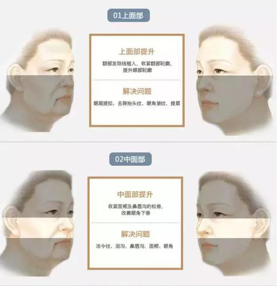 解决问题