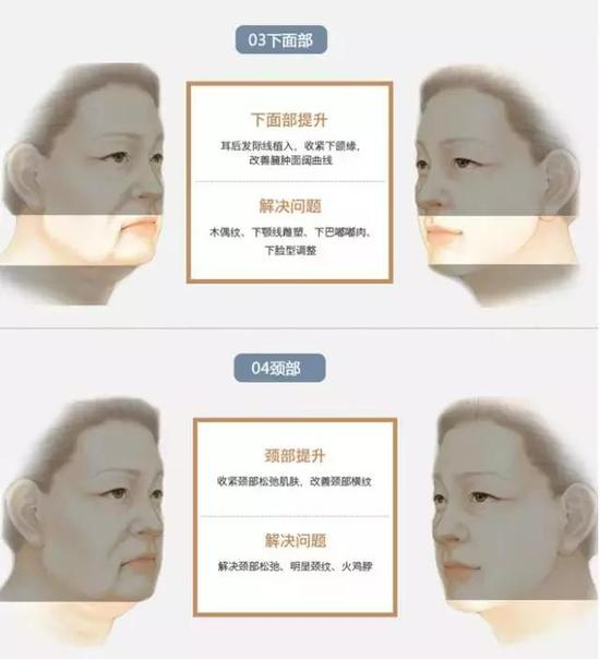 解决问题