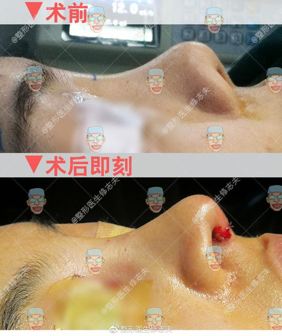 对比