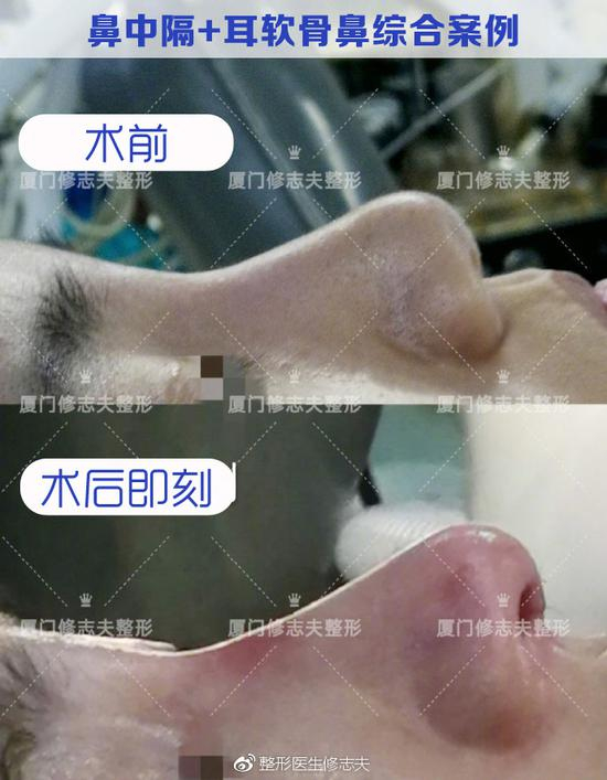 对比