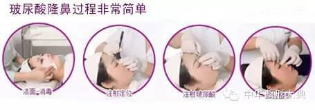 优势
