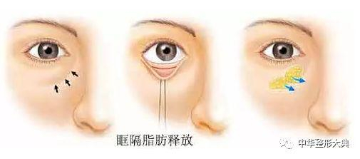 手术