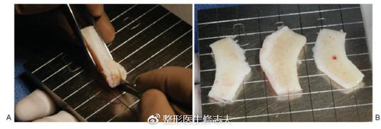 雕刻