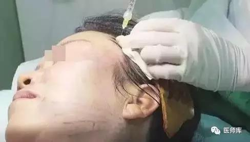 步骤
