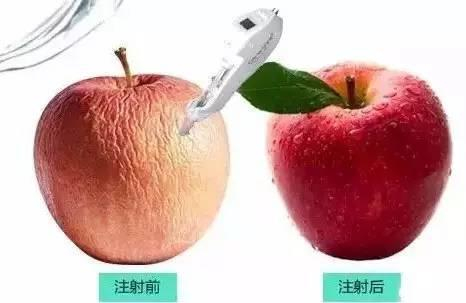注射效果