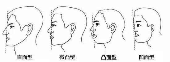 面型