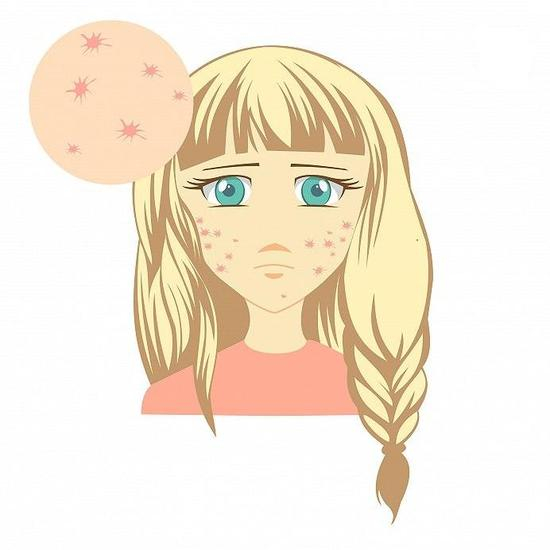 痘痘