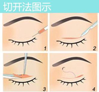 切开法