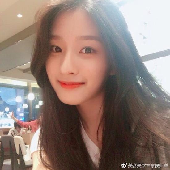激光治疗