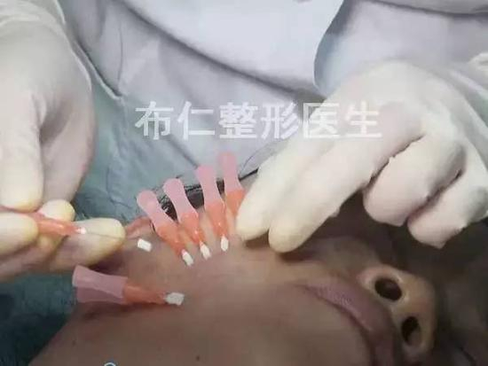 步骤图解13