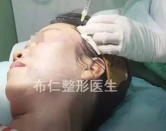 步骤图解1