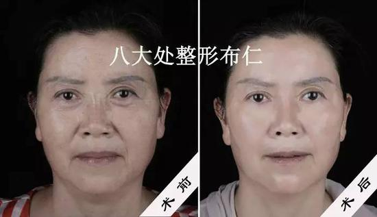 对比